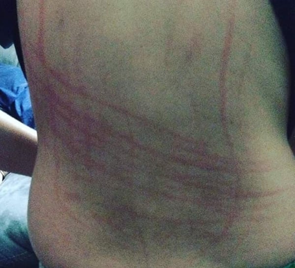 paranormal attack, scratches, not demonic